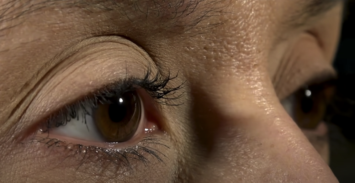 What Causes Ocular Hypertension Essential Insights